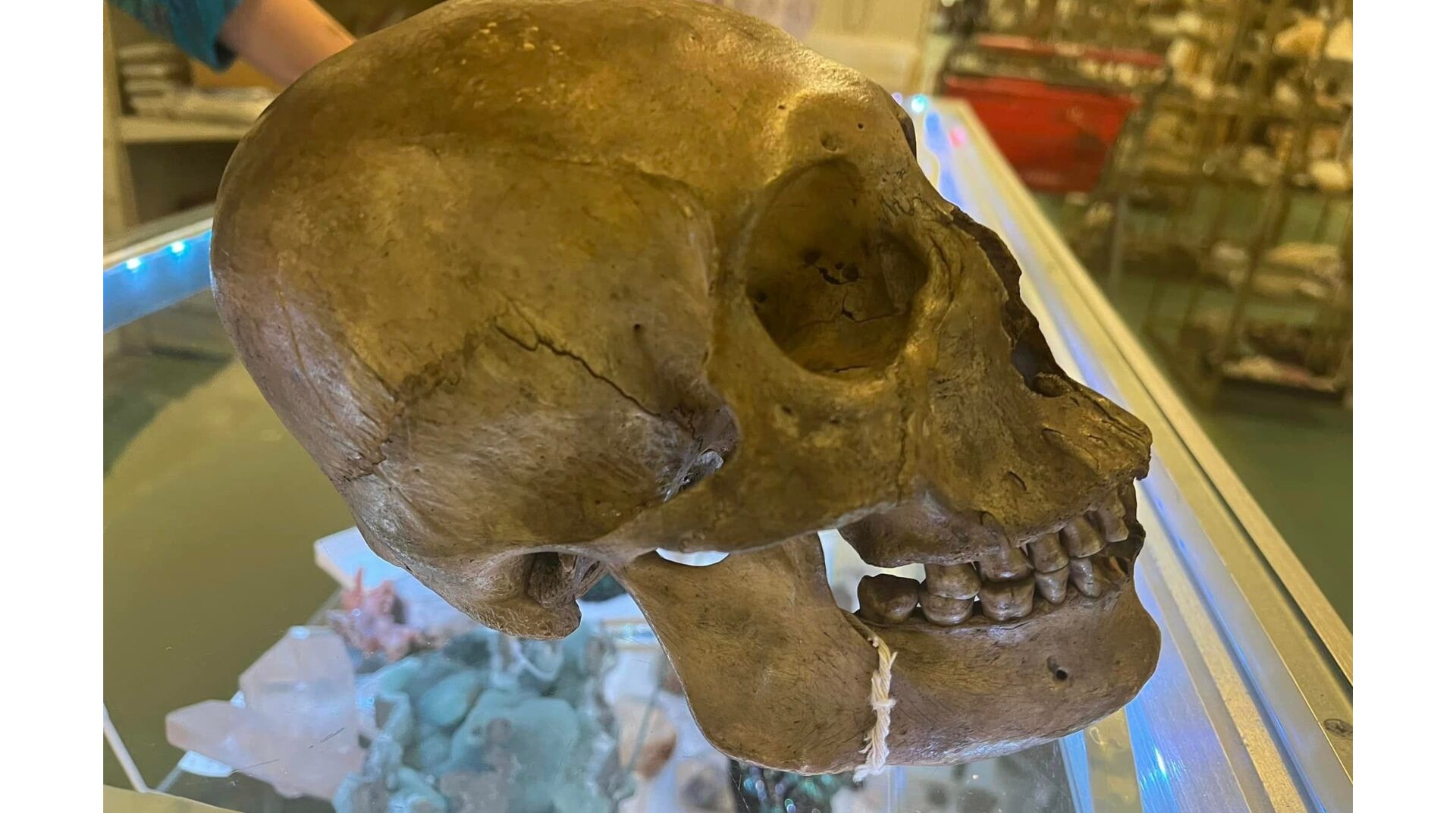 College Students Solve 30-Year Bone Mystery, Skull Found in 1995 Linked to 1844